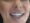 Dental